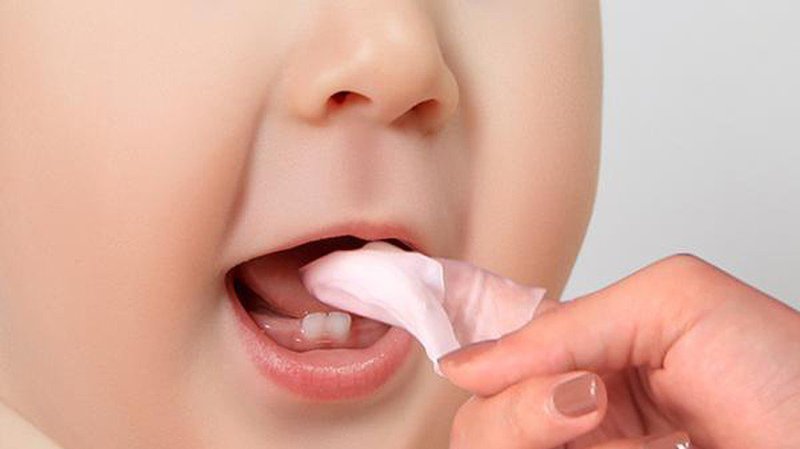 cách chữa nhiệt miệng ở trẻ sơ sinh