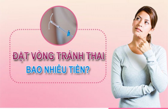 Chi phí đặt vòng tránh thai hết bao nhiêu tiền